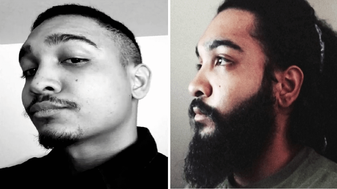 Minoxidil-Before-and-After-Beard-Growth-Transformation